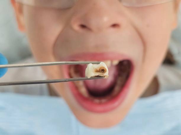 Best Emergency TMJ Treatment in Quinlan, TX
